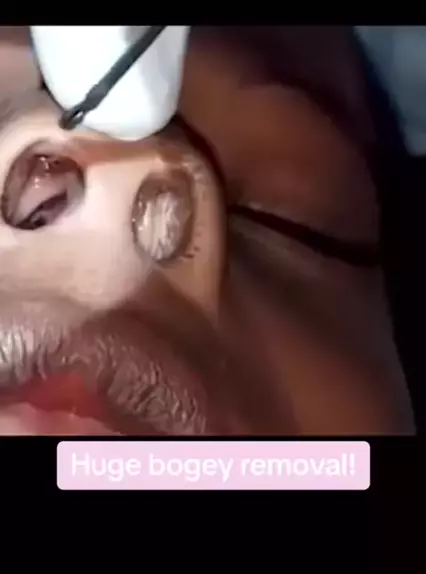 nippyspace virus removal | Discover